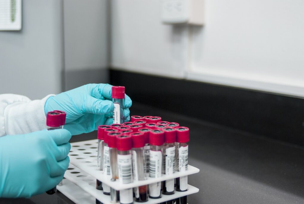 Advanced functional medicine in Camp Hill, PA requires testing.